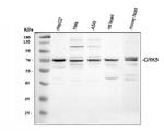 GRK5 Antibody in Western Blot (WB)