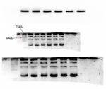 GRK5 Antibody in Western Blot (WB)