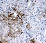 GSTA1/A2/A3/A4/A5 Polyclonal Antibody