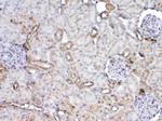 GSTP1 Antibody in Immunohistochemistry (Paraffin) (IHC (P))