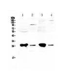 GSTT1 Polyclonal Antibody