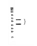 TIM-3 Polyclonal Antibody