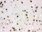 HDAC11 Polyclonal Antibody