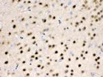 HDAC11 Antibody in Immunohistochemistry (Paraffin) (IHC (P))