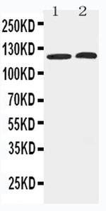 HDAC5 Polyclonal Antibody
