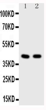 HDAC8 Antibody in Western Blot (WB)