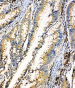HEXA Polyclonal Antibody