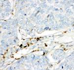 HEXB Polyclonal Antibody