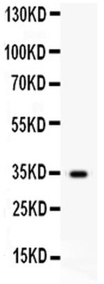 HGF Polyclonal Antibody