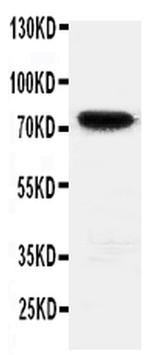 HIF3A Polyclonal Antibody