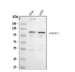 HKDC1 Polyclonal Antibody