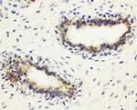 HLA-DMB Polyclonal Antibody