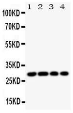 HLA-DMB Antibody in Western Blot (WB)