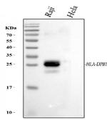 HLA-DPB1 Antibody in Western Blot (WB)