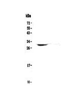 HLA-DQB1 Antibody in Western Blot (WB)