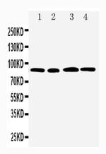 RHAMM Antibody in Western Blot (WB)