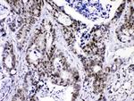 hnRNP F Polyclonal Antibody