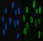 hnRNP L Polyclonal Antibody