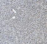 hnRNP L Antibody in Immunohistochemistry (Paraffin) (IHC (P))