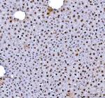 hnRNP L Antibody in Immunohistochemistry (Paraffin) (IHC (P))