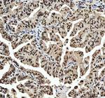 hnRNP L Antibody in Immunohistochemistry (Paraffin) (IHC (P))