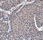 hnRNP L Antibody in Immunohistochemistry (Paraffin) (IHC (P))