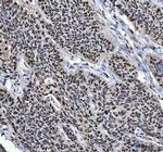 hnRNP L Antibody in Immunohistochemistry (Paraffin) (IHC (P))
