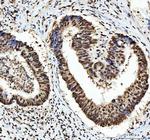 hnRNP L Antibody in Immunohistochemistry (Paraffin) (IHC (P))