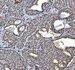 hnRNP L Antibody in Immunohistochemistry (Paraffin) (IHC (P))