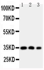HOXA4 Antibody in Western Blot (WB)