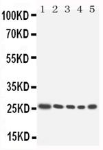 HOXA6 Polyclonal Antibody