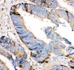 HRG Polyclonal Antibody