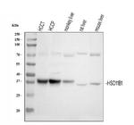 HSD11B1 Antibody in Western Blot (WB)