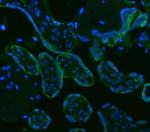 HSD11B2 Polyclonal Antibody