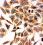 HSD17B1 Polyclonal Antibody