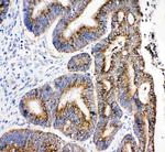HSD17B4 Polyclonal Antibody
