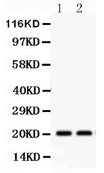 HSPB2 Polyclonal Antibody