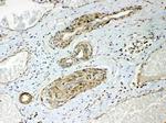 HSPB8 Antibody in Immunohistochemistry (Paraffin) (IHC (P))