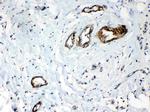 HSPB8 Antibody in Immunohistochemistry (Paraffin) (IHC (P))