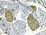 HSPB8 Antibody in Immunohistochemistry (Paraffin) (IHC (P))