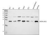 HSPB8 Antibody in Western Blot (WB)