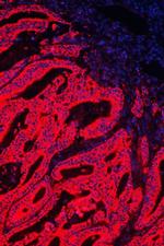 HSPE1 Antibody in Immunohistochemistry (Paraffin) (IHC (P))