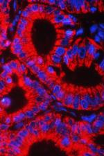 HSPE1 Antibody in Immunohistochemistry (Paraffin) (IHC (P))