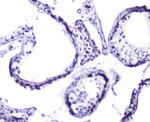 HSP105 Antibody in Immunohistochemistry (Paraffin) (IHC (P))