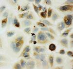 HYAL1 Polyclonal Antibody