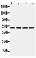 HYAL1 Polyclonal Antibody