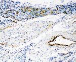 HYAL3 Polyclonal Antibody