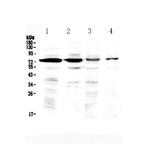 Bone SialoProtein Polyclonal Antibody