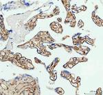 ICAM-1 (CD54) Antibody in Immunohistochemistry (Paraffin) (IHC (P))