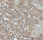 ICAM-1 (CD54) Antibody in Immunohistochemistry (Paraffin) (IHC (P))